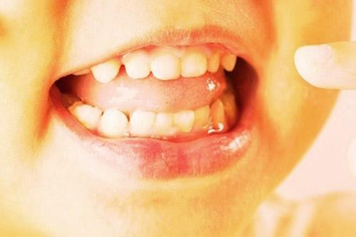 Có thể nuôi cấy răng mới từ tế bào mầm của răng sữa