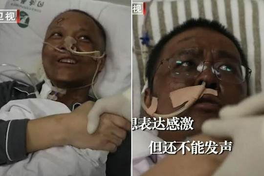 Bác sĩ Trung Quốc đổi màu da sau thời gian dài điều trị COVID-19