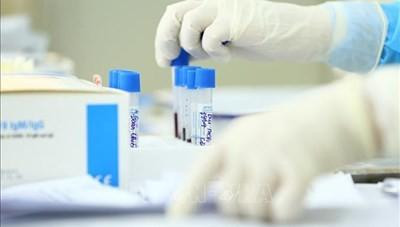 Viện Pasteur Nha Trang tiếp tục xét nghiệm xác định dương tính với SARS-CoV-2 cho 11 tỉnh miền Trung