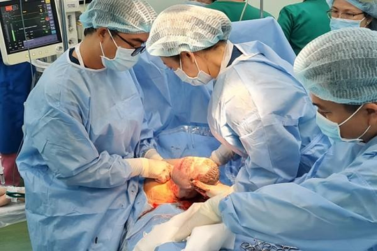 Hai bệnh viện hợp sức cứu thai nhi có khối u khổng lồ