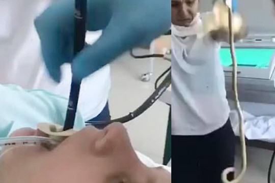 Ghê rợn clip bác sĩ cứu người phụ nữ bị rắn chui vào miệng lúc ngủ gật 