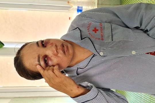 Quảng Bình: Chồng đã ly dị đánh dã man vợ cũ