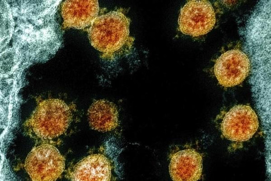 Biến thể SARS-CoV-2 ảnh hưởng đến phát triển vắc xin
