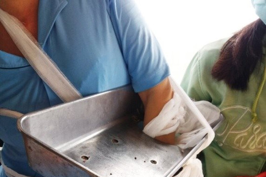 Hỗ trợ người phụ nữ bị nghiền nát bàn tay khi vệ sinh máy xay thịt