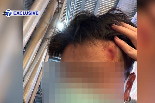Một phụ nữ châu Á bị tấn công bằng búa tại New York
