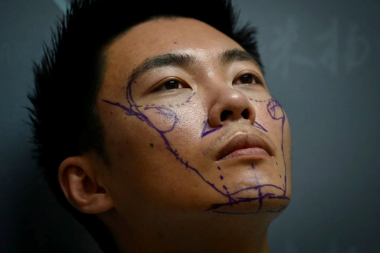 Ngày càng nhiều đàn ông Trung Quốc phẫu thuật thẩm mỹ để thay đổi cuộc sống 
