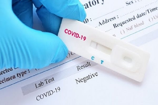 Bộ Y tế đề nghị các đơn vị báo cáo giá bán test xét nghiệm COVID-19