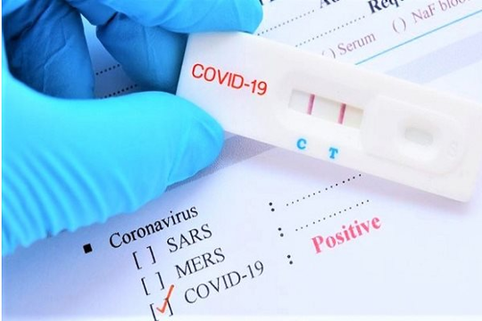 Bộ Y tế giải thích về chi phí test nhanh COVID-19 đắt tới 238.000 đồng/mẫu