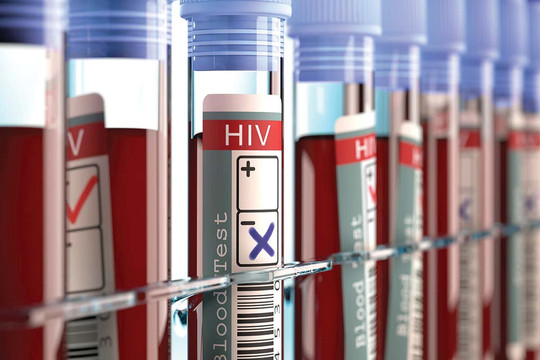 Phát hiện ra biến chủng vi rút HIV có độc lực cao ở Hà Lan