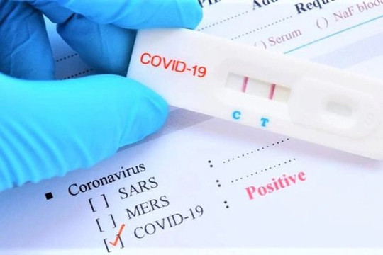 Bộ Y tế ra thông tư mới điều chỉnh giá xét nghiệm COVID-19