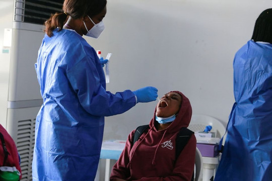 WHO: Tổng ca COVID-19 toàn cầu hơn 16 lần số ghi nhận, hơn 2/3 người châu Phi nhiễm SARS-CoV-2