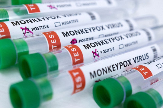 Các hãng chạy đua phát triển và sản xuất kit xét nghiệm đậu mùa khỉ khi ca bệnh tăng cao