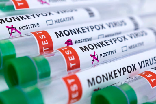 Lan truyền tin đồn sai lệch rằng bệnh đậu mùa khỉ là 'tác dụng phụ' của vắc xin AstraZeneca