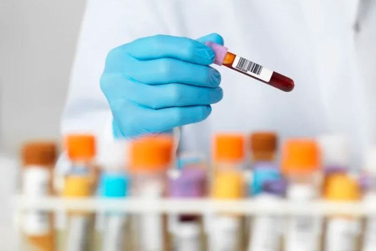 Cách xét nghiệm máu mới tìm mức độ và thời gian miễn dịch với COVID-19