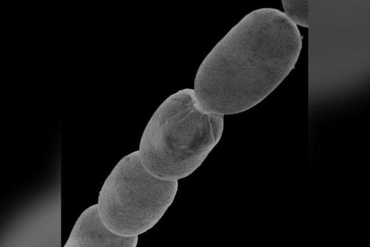 Phát hiện vi khuẩn lớn nhất thế giới có kích thước bằng lông mi người