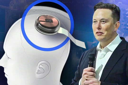 Elon Musk: Chip não không dây Neuralink có thể  phục hồi thị lực cho người mù bẩm sinh