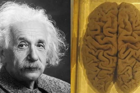 Giải phẫu bộ não của Einstein và các thiên tài để phát hiện điểm khác người thường
