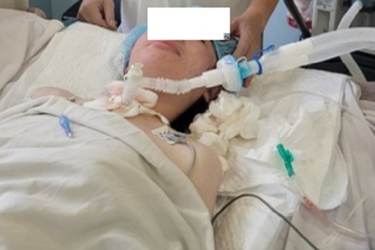 Thiếu nữ 17 tuổi suýt chết do bị khối u làm tắc khí quản