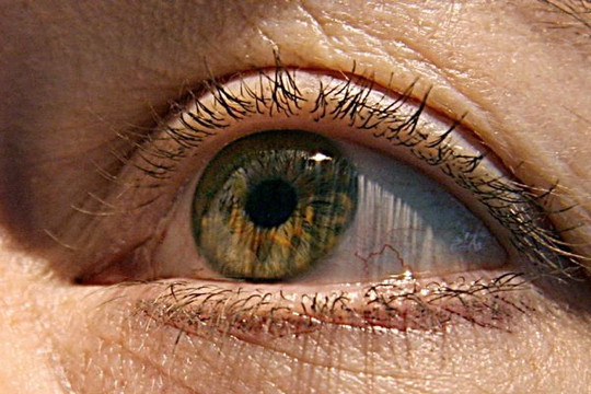Dấu hiệu đầu tiên của Alzheimer xuất hiện ở mắt