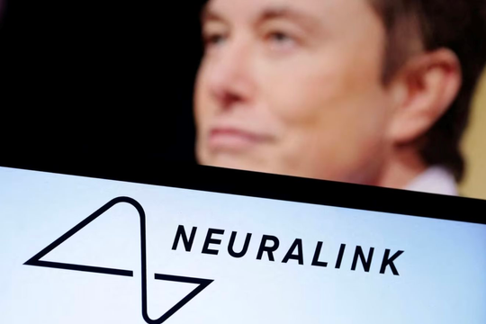 Công ty Neuralink của Elon Musk được cấp phép cấy ghép não người