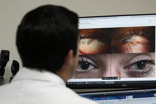 Tin vui y học: Thuốc nhỏ mắt liệu pháp gien có thể trị các bệnh về mắt