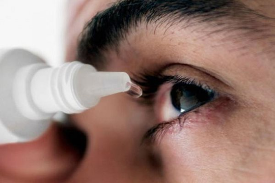 Bệnh đau mắt đỏ do enterovirus và adenovirus gây ra có nguy hiểm?