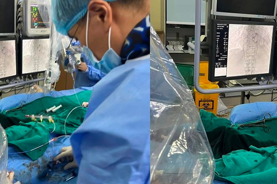 Lần đầu tiên tại Việt Nam thực hiện thành công thay van trong van động mạch chủ