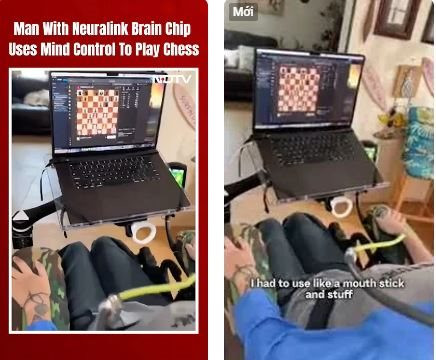 Video bệnh nhân liệt tứ chi được Neuralink cấy ghép chip não chơi cờ online