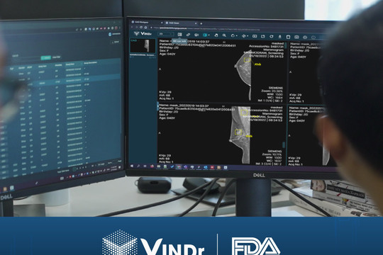 Sản phẩm AI của VinBigdata đạt chứng nhận của FDA, chính thức vào thị trường Mỹ