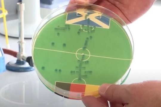 Vi khuẩn dự đoán kết quả trận mở màn Euro 2024