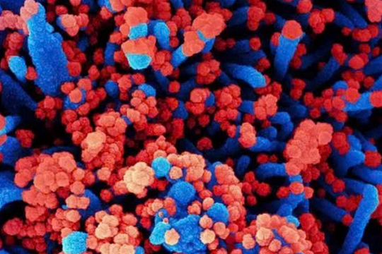 Bệnh chưa rõ nguyên nhân tại Liên bang Nga: Liệu có phải do vi khuẩn Mycoplasma?