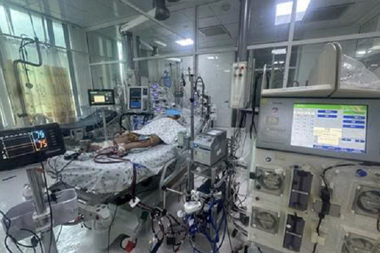 Bé gái 8 tuổi ở An Giang được cứu sống nhờ kỹ thuật ECMO