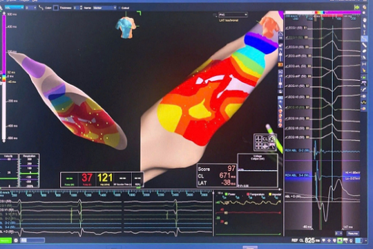 Người phụ nữ ở Đồng Tháp thoát chết nhờ công nghệ 3D hiện đại