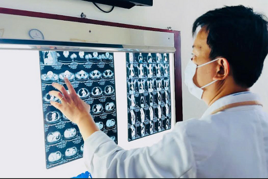 Thoát 'án treo' sau 30 năm mang khối bướu giáp