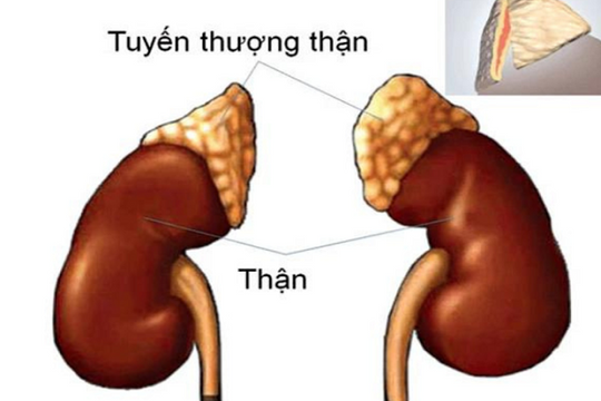 TP.HCM: Nhiều người cao tuổi mắc bệnh nguy hiểm bị chẩn đoán nhầm