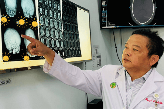 Đầu trẻ bị méo, dẹt: Cảnh báo trẻ sơ sinh dính khớp sọ!
