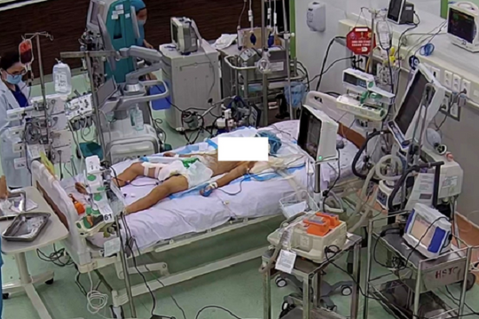 20 phút ngưng tim và kỳ tích hồi sinh nhờ kỹ thuật ECMO