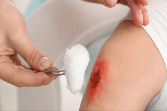Sai lầm sơ cứu trong 5 phút đầu có thể trả giá bằng cả đời trẻ
