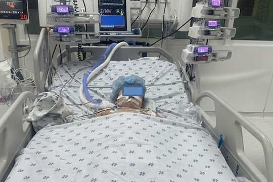Ứng dụng NPWT và phẫu thuật tạo hình cứu em bé bị tai nạn lóc da diện rộng