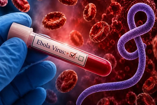 Việt Nam kích hoạt 'lá chắn thép' y tế ứng phó Ebola