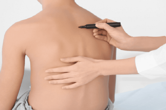 Chỉ 3 phút mỗi tuần có thể cứu cột sống của con