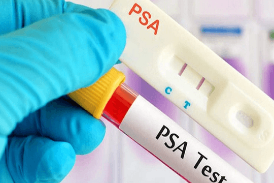 PSA tăng có phải ung thư tuyến tiền liệt?