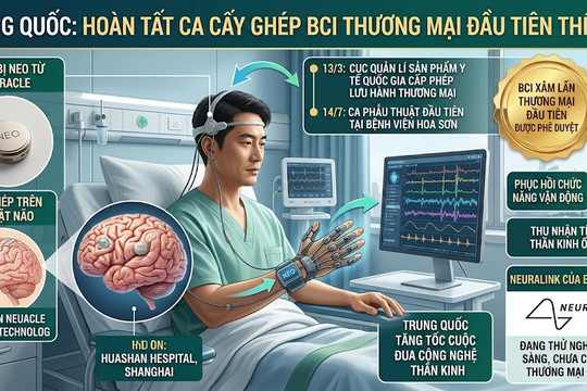 Trung Quốc hoàn tất ca cấy ghép giao diện não - máy tính thương mại đầu tiên thế giới