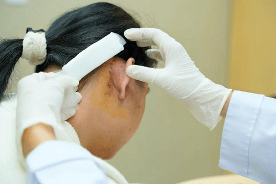 Trẻ điếc bẩm sinh: Vì sao 12-18 tháng là ‘thời gian vàng’ để can thiệp?