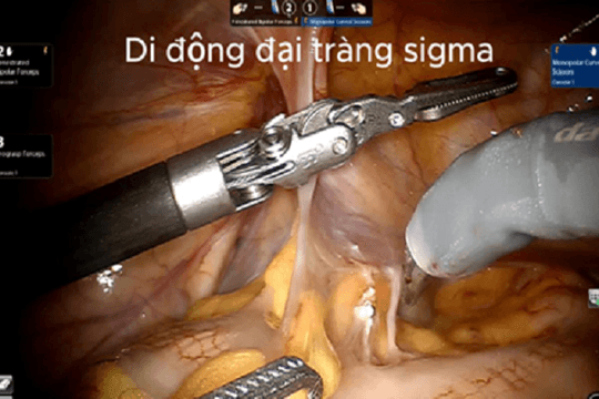 Mất bàng quang vì ung thư, bệnh nhân vẫn có thể ‘đi tiểu như thường’