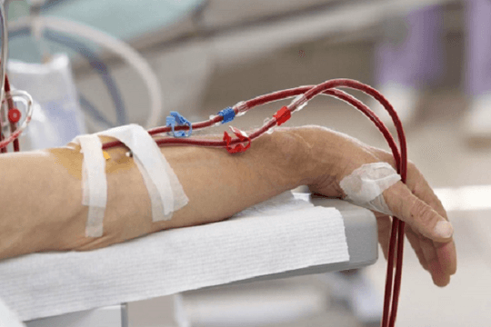 Nghịch lí chạy thận nhân tạo: Vì sao máy sạch độc tố, người bệnh vẫn tuyệt vọng?