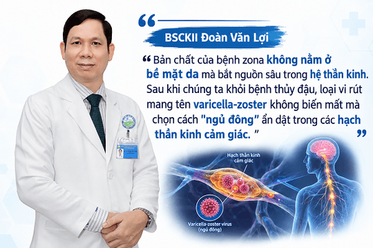 Nỗi ám ảnh sau zona thần kinh: Da đã lành, vì sao cơn đau vẫn ‘gặm nhấm’ người bệnh?