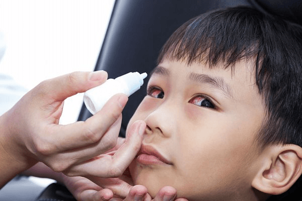 Bộ Y tế: Không để thiếu thuốc và đầu cơ, tăng giá thuốc chữa đau mắt đỏ