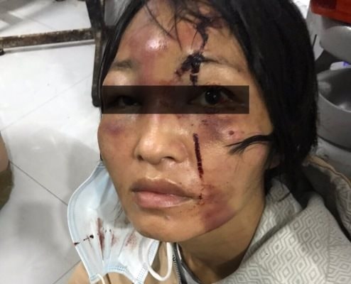 An Giang: Bắt giam gã ‘phi công’ bạo hành  người tình và con riêng 