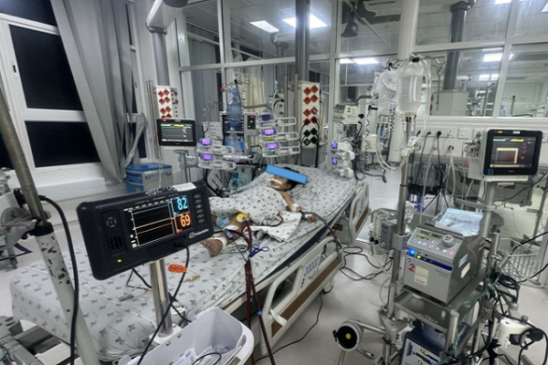 Sau 1 ngày sốt nhẹ, bé gái 5 tuổi bị nguy kịch do viêm cơ tim tối cấp